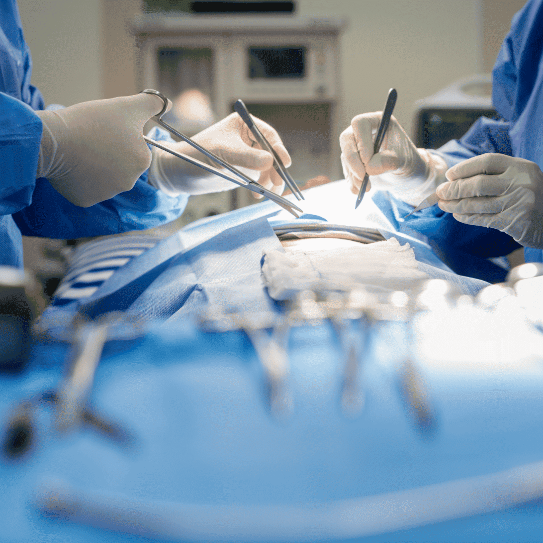 Ablation chirurgicale d’une tumeur Ablation chirurgicale d’une tumeur